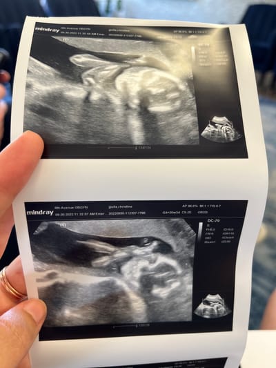 We’re having a baby.