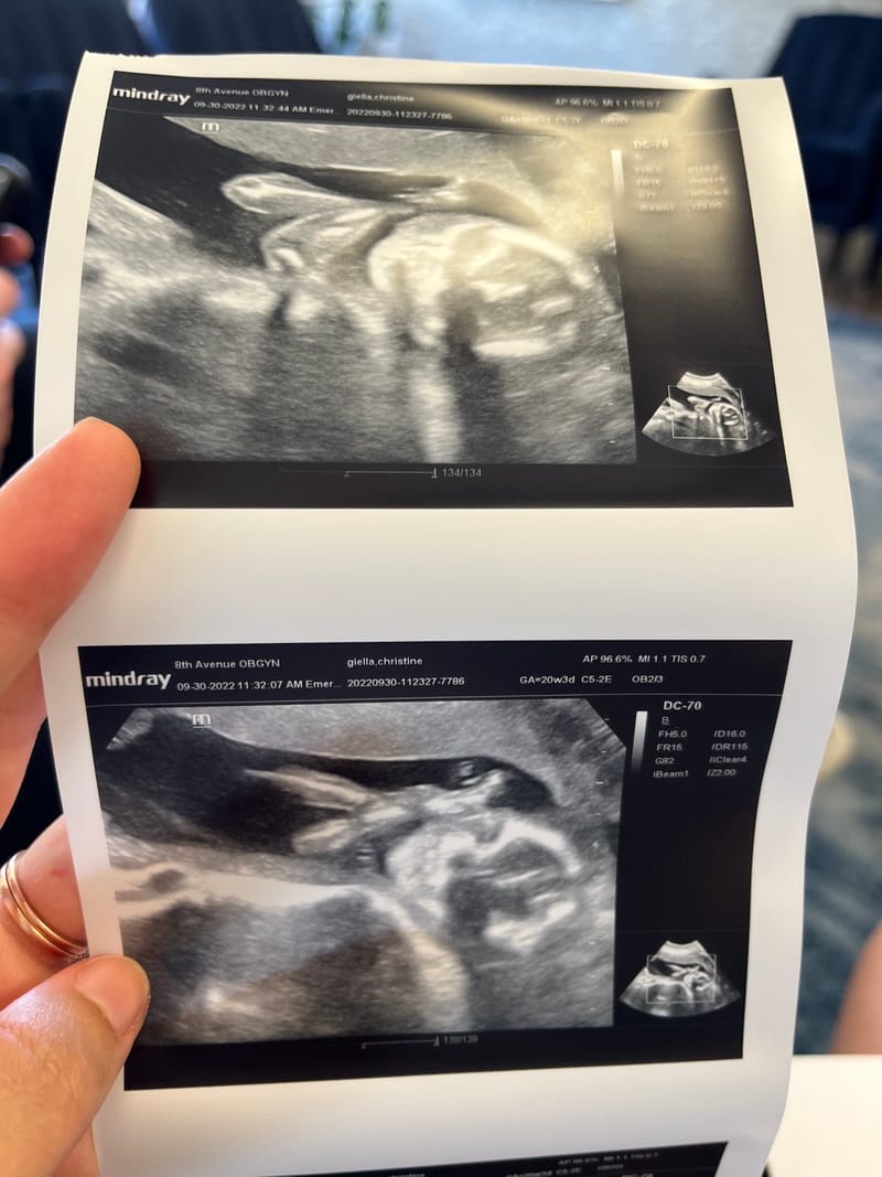 We’re having a baby.